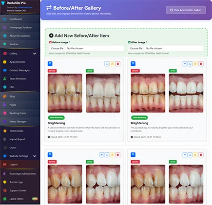 Before/After Gallery Manager